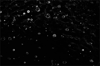 Anfang / ....................................